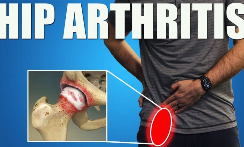 Reclaim Joint Health: Beat Hip Pain & Boost Mobility! Reclaim Joint Health: Beat Hip Pain & Boost Mobility!